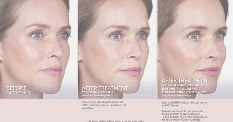 A Duo to Talk About Before & After Video Stephanie